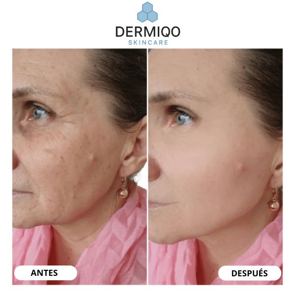 Dermiqo™ – Colágeno de Seda Nano Liofilizado Antiarrugas